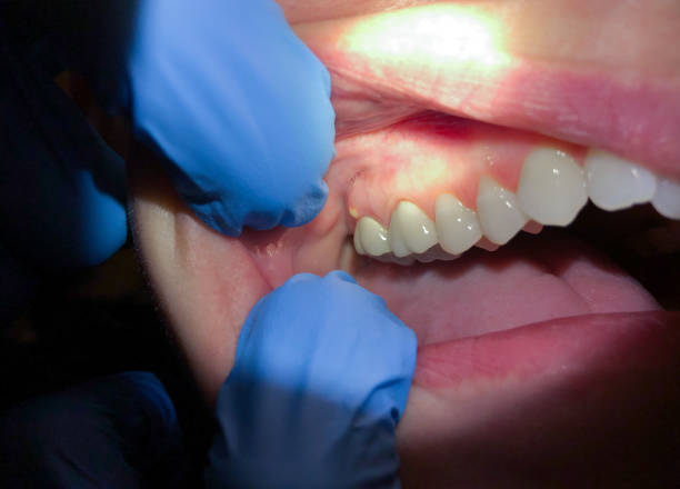 Best Same-Day Emergency Dental Services in Columbus Af, MS