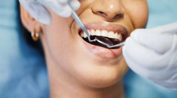 Best Pediatric Emergency Dentist in Columbus Af, MS