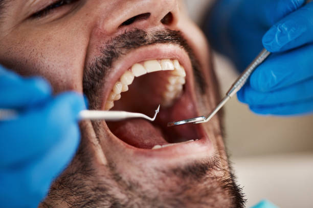 Best After-Hours Dental Trauma Care in Columbus Af, MS