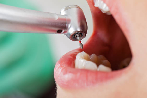Best Same-Day Emergency Dental Services in Columbus Af, MS